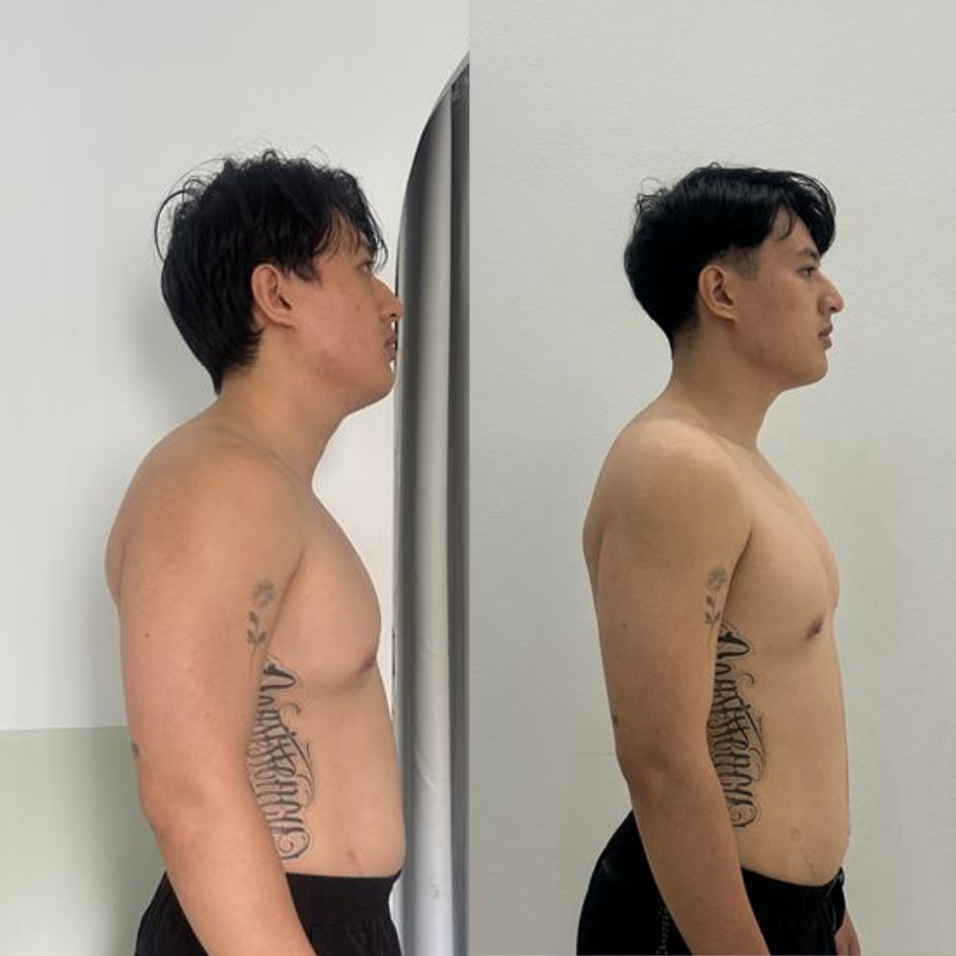 Better form, real results transformation
