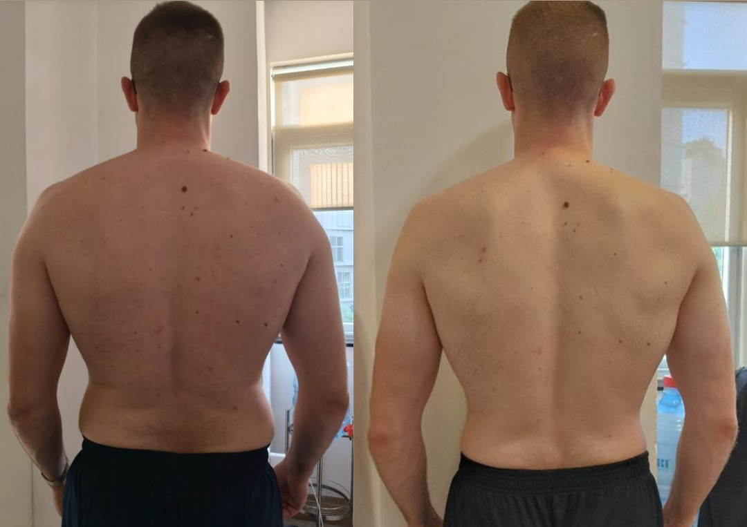 Lightest since university transformation